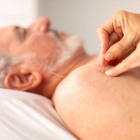 L’acupuncture et les médecines douces pour les seniors : mieux vivre après 60 ans