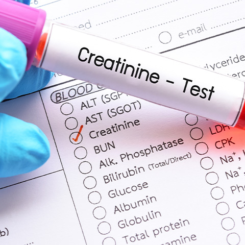 Créatinine élevée chez les personnes âgées : ce que vous devez savoir