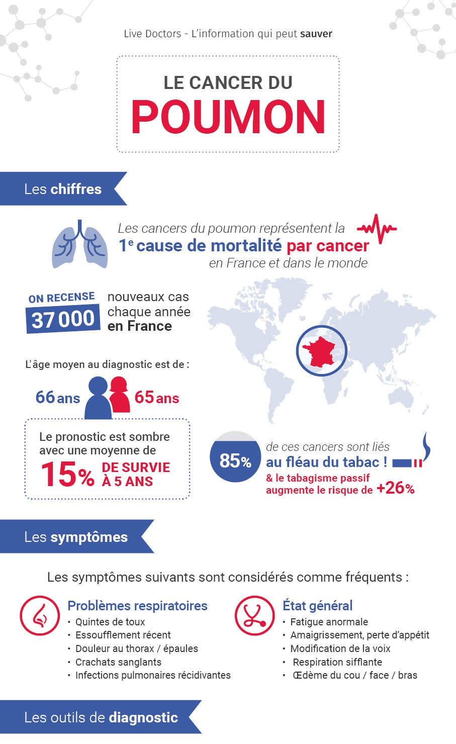 Cancer du poumon : Une infographie complète