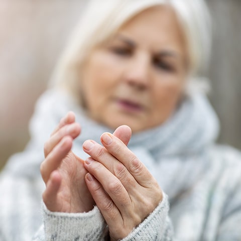 Arthrose de la main : un nouveau médicament prometteur